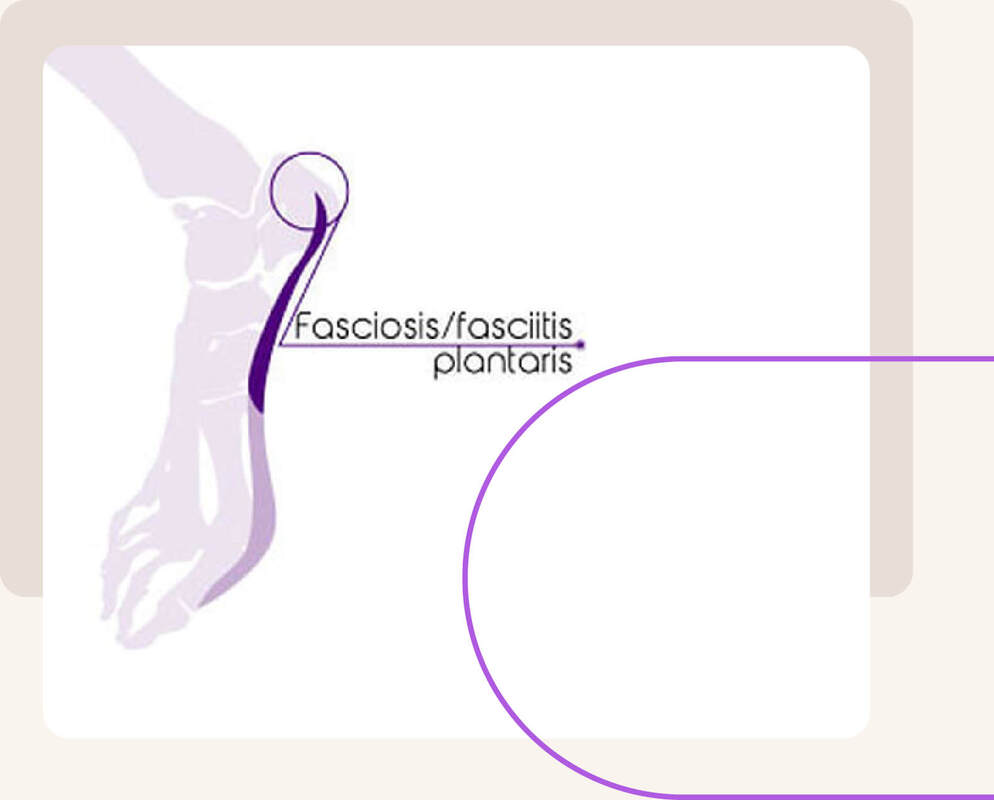 Fasciitis plantaris peesplaatontsteking
