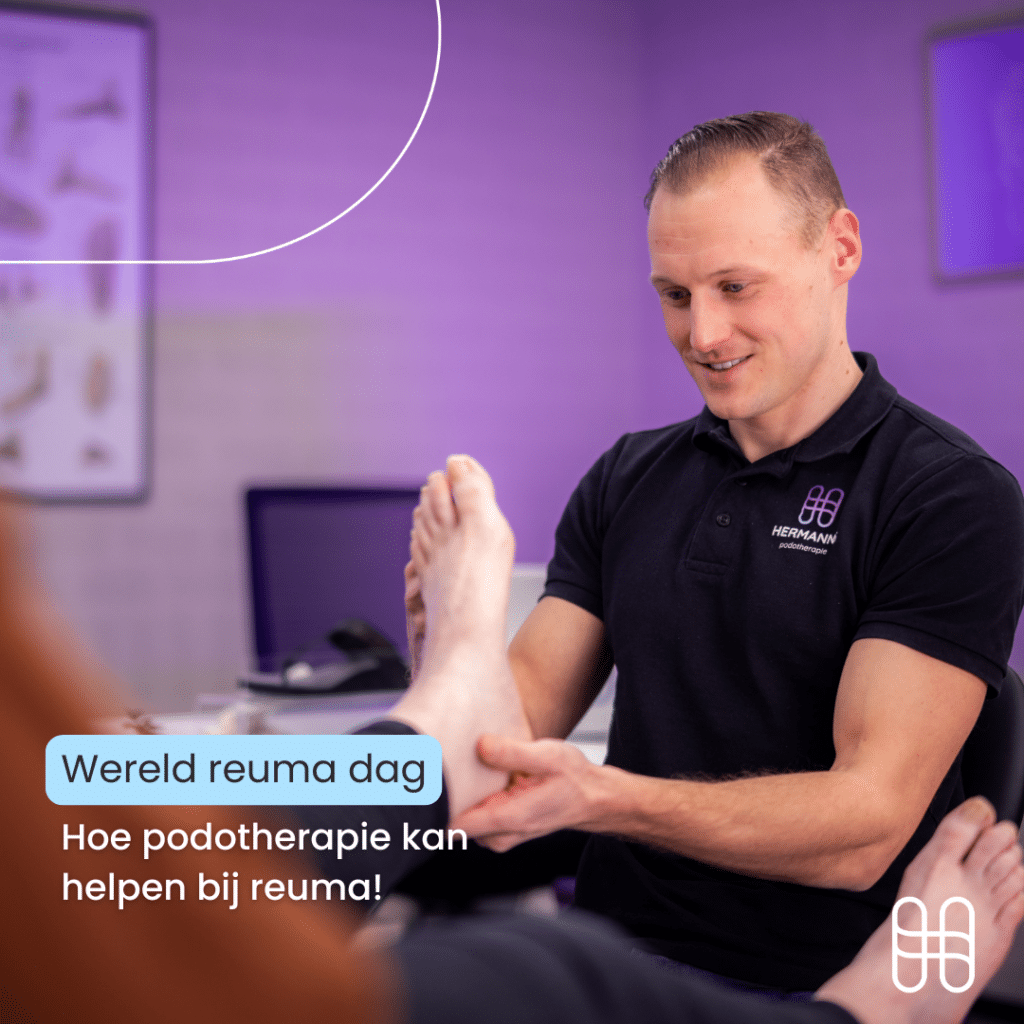 Wereld Reuma Dag: Hoe Podotherapie kan Helpen bij Reuma