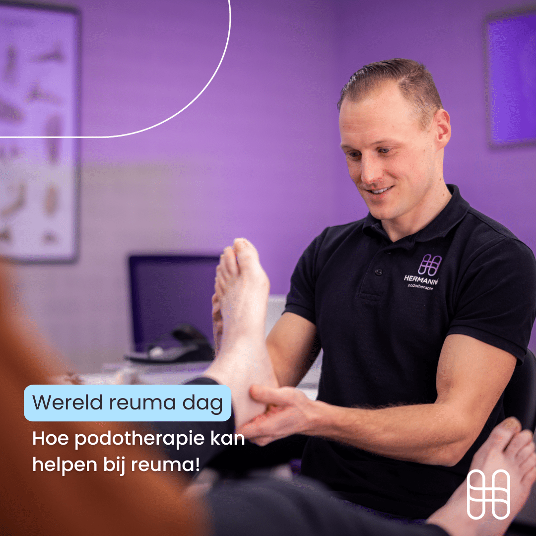 Wereld Reuma Dag: Hoe Podotherapie kan Helpen bij Reuma