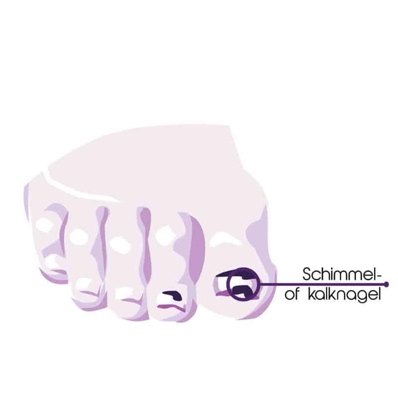 Teenklachten