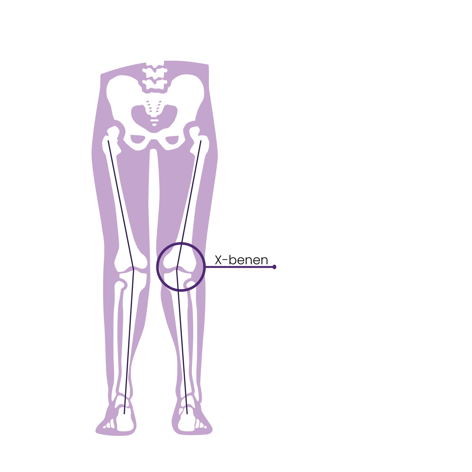 x-benen