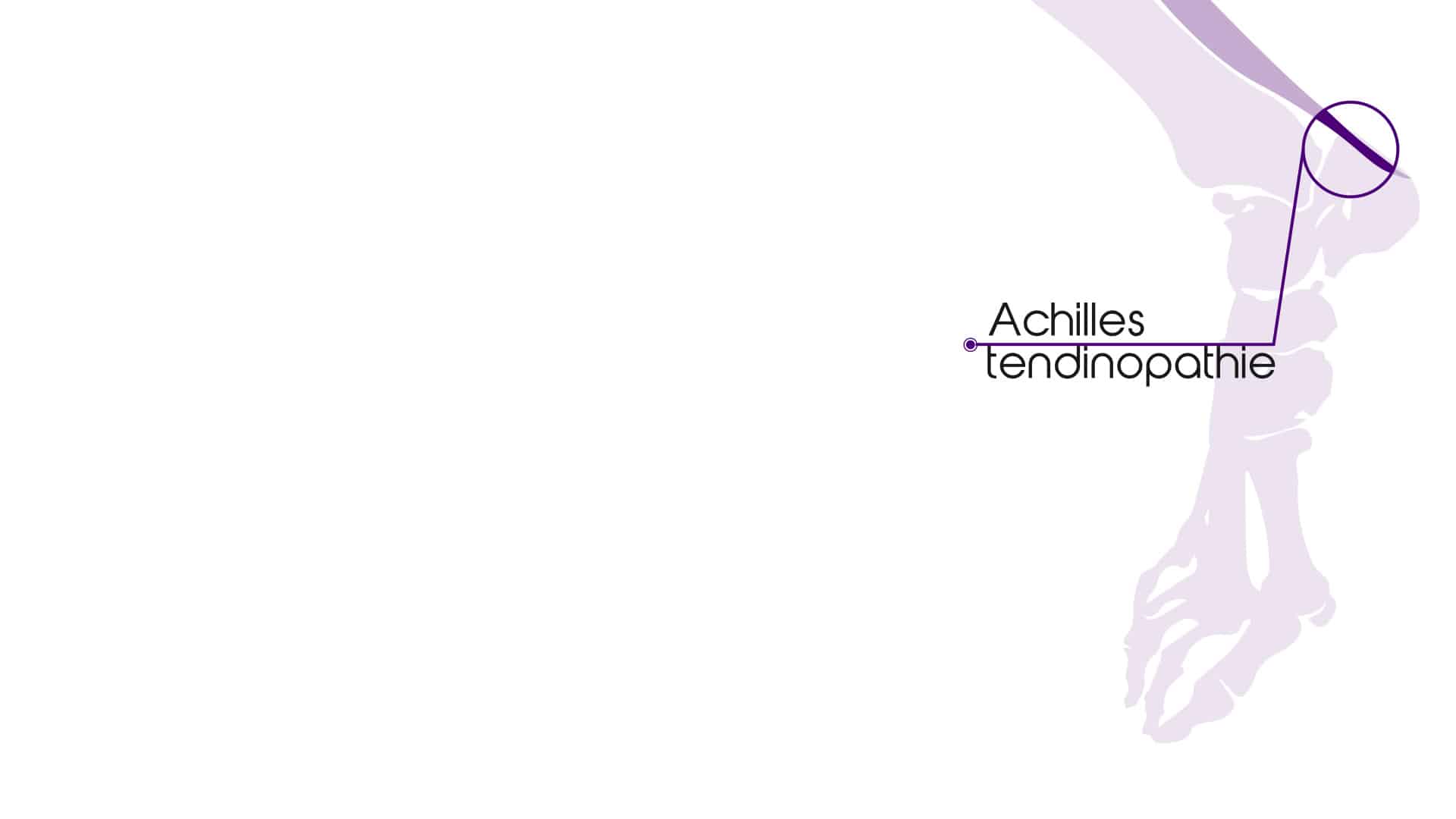ontstoken achillespees