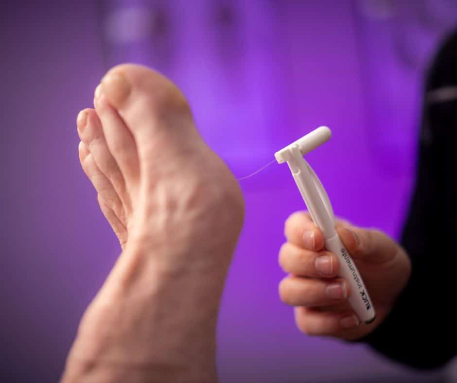 Basisverzekerde voetzorg Podotherapie Hermanns