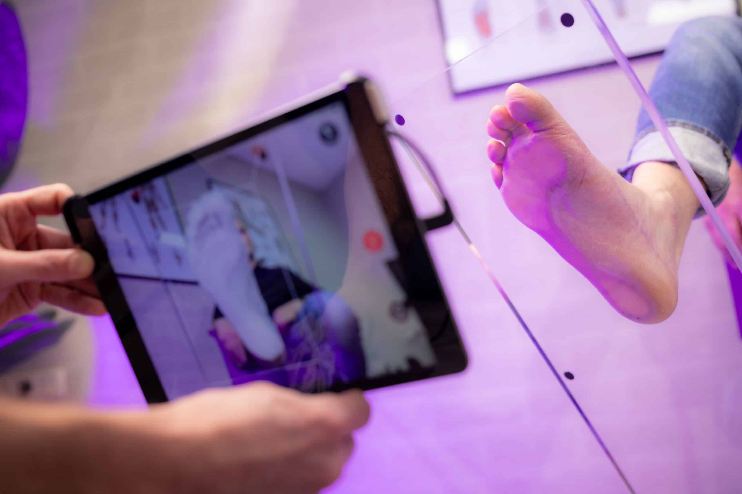 Oorzaken van hallux valgus