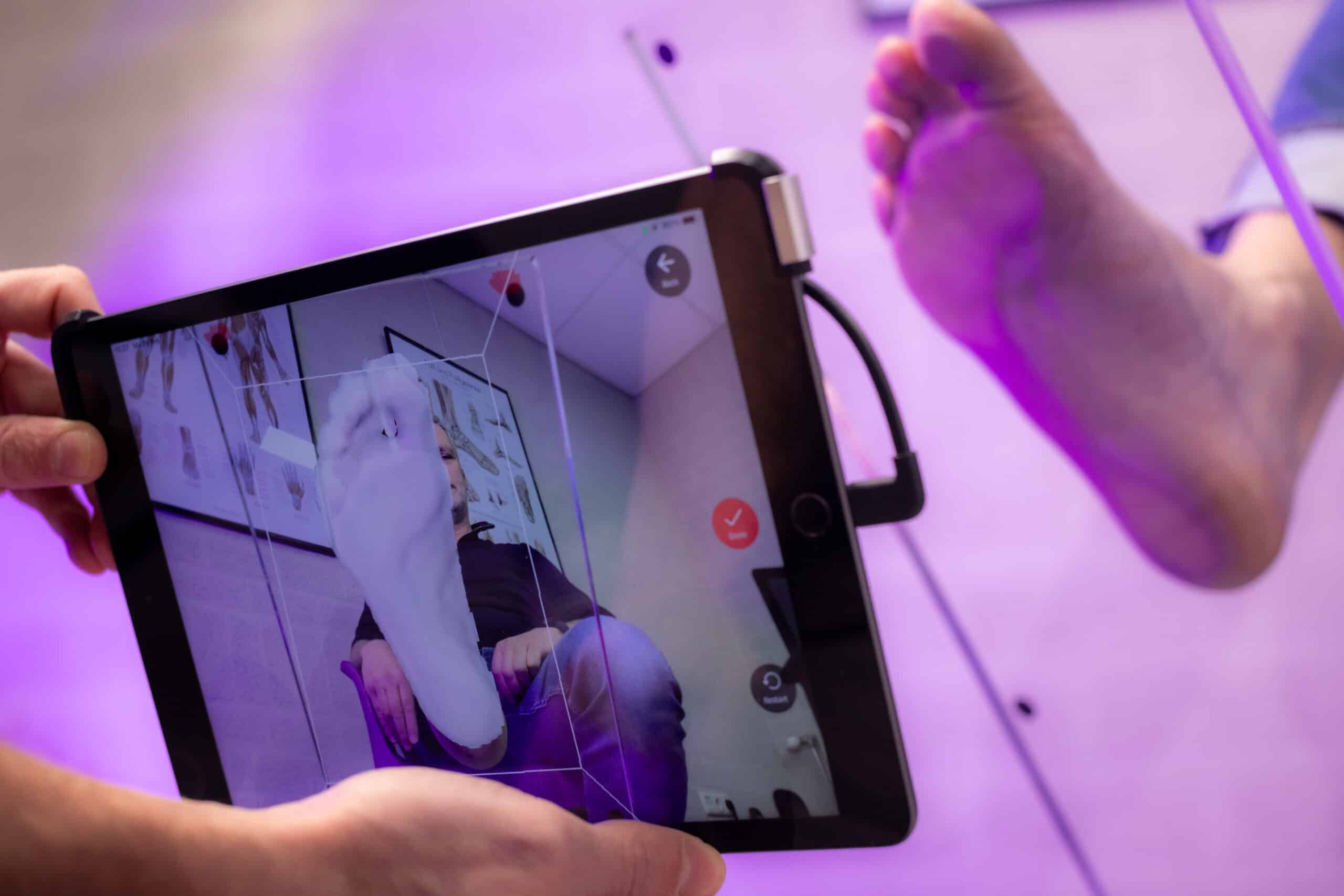 Steunzolen Bij Capsulitis