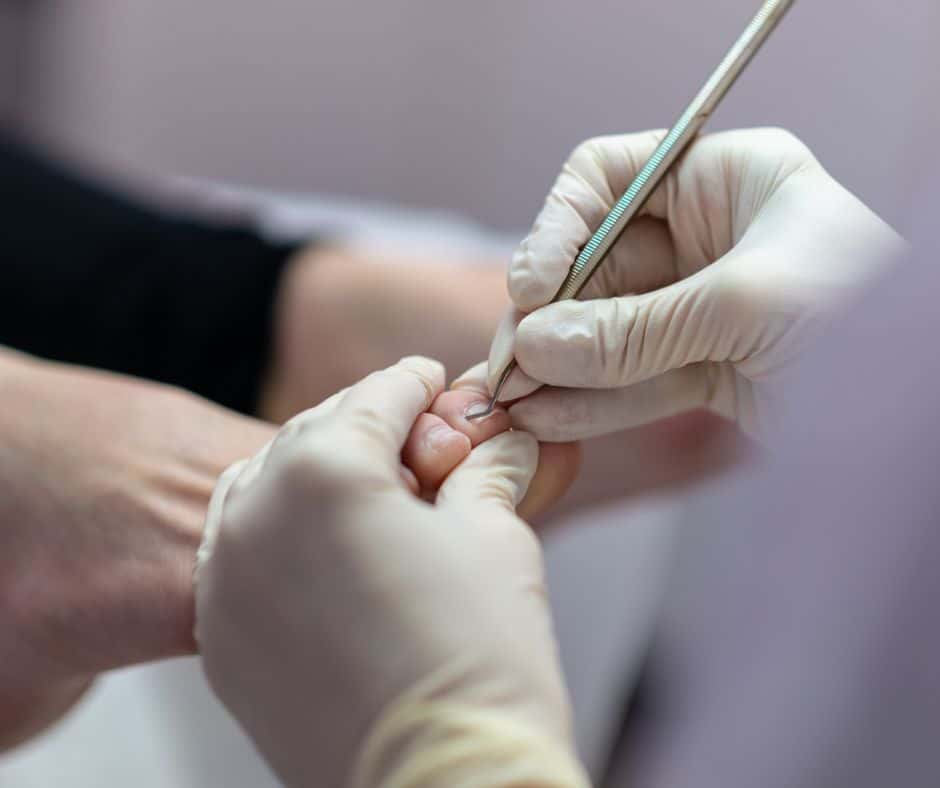 Pedicurezorg Basisverzekerde voetzorg