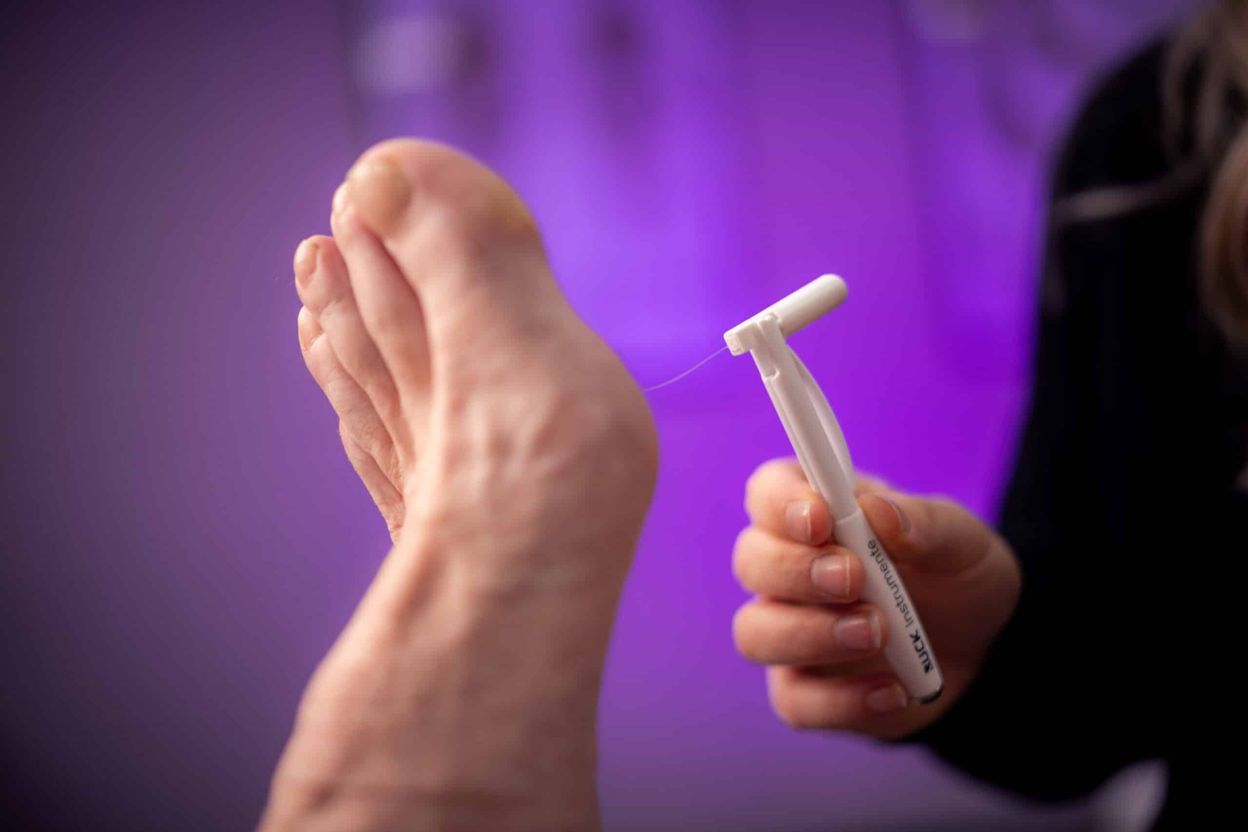 Voetzorg Bij Kankerpatienten Preventie En Behandeling Van Voetcomplicaties